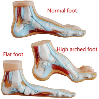  Медицинска анатомия на Крака на човека Нормално стъпало е Плоска и извита Анатомическая модел на стъпалото на човека Модел Sketelon Плоски високи извити крака 3 бр./компл.